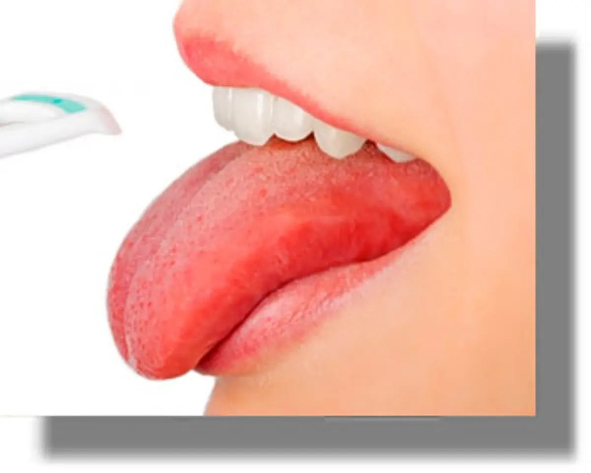 Έχετε λευκή γλώσσα; Μάθετε τα αίτια του παράξενου φαινομένου