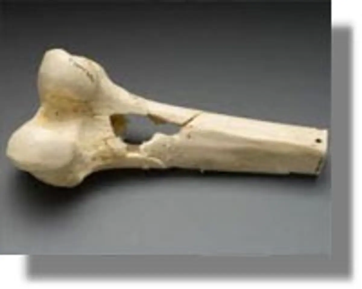 ΚΩΣ: Τουρίστας πήγε να κάνει μπάνιο και βρήκε ανθρώπινο οστό!