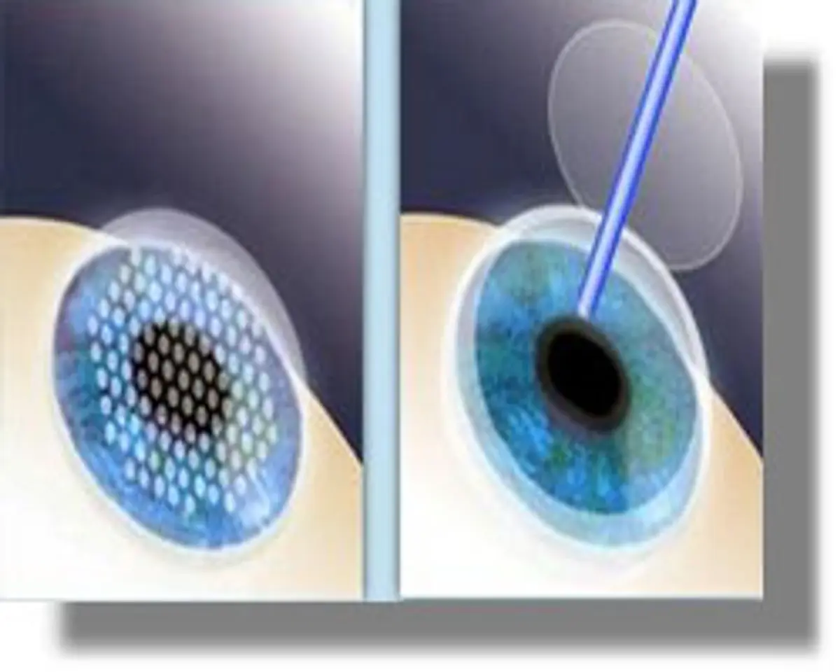 Ιωάννης Παϊσιος