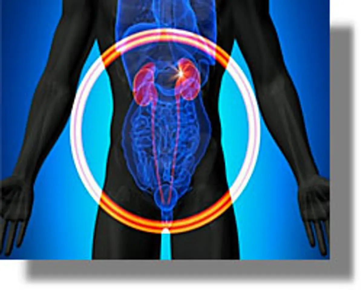 πρόβλημα νεφρά