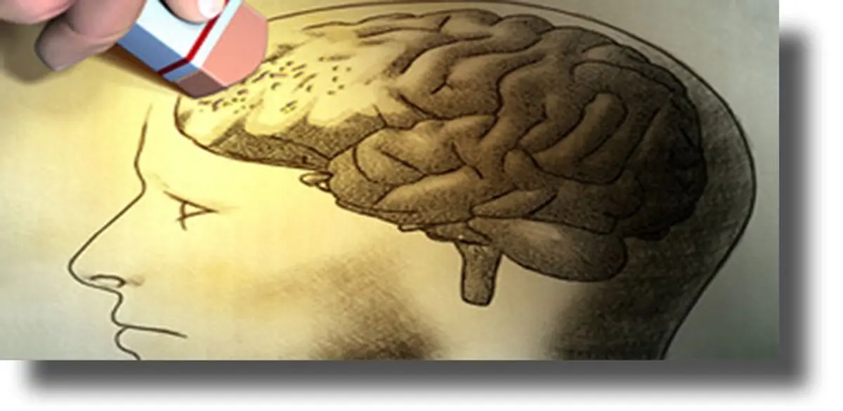 Αυτό το σύμπτωμα της νόσου Αλτσχάιμερ εμφανίζεται μια δεκαετία πριν από την απώλεια μνήμης!